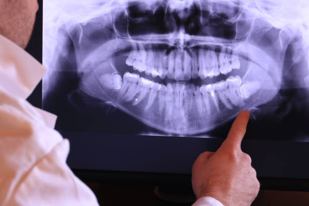 Best Teeth Whitening  in Harrah, OK